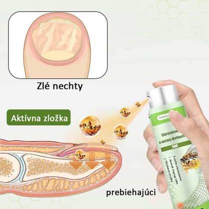 🔥Najobľúbenejšie丨50 % zľava na obmedzený čas | Foulme® NailRescue sprej s včelím jedom🐝