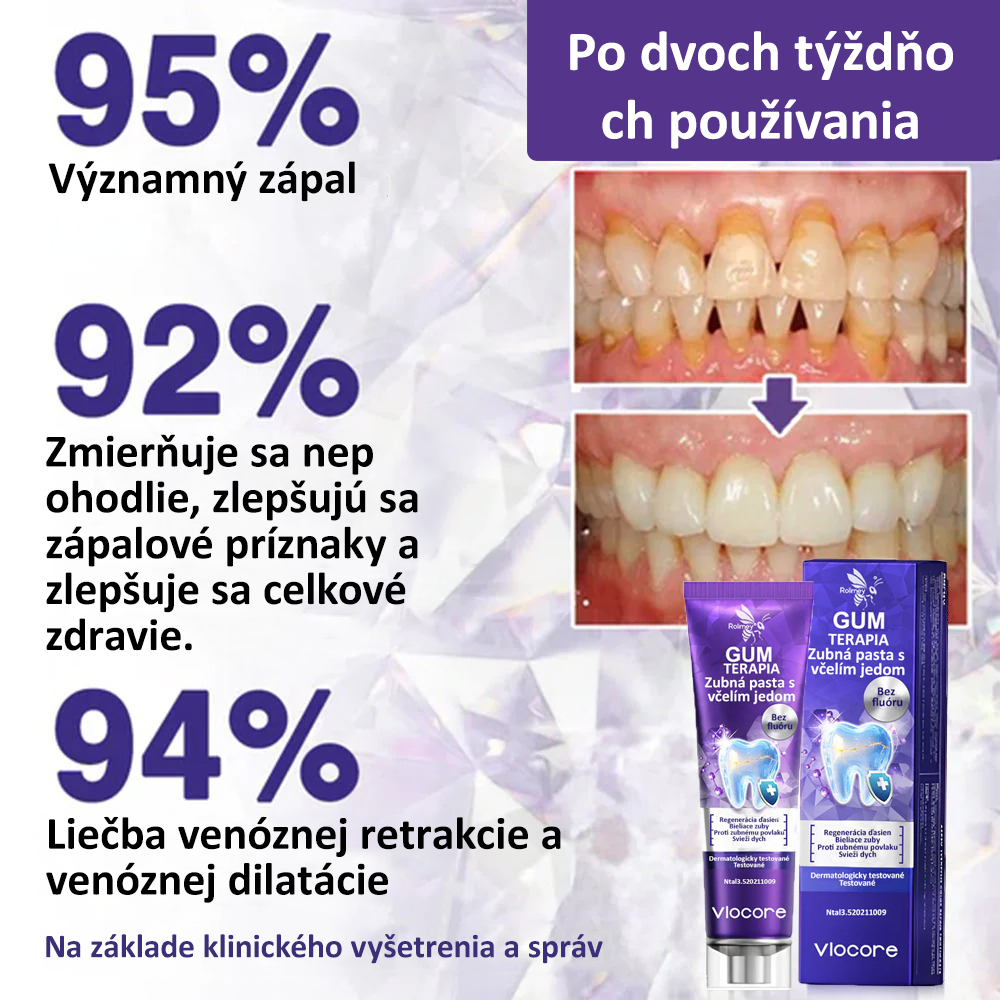 🌟Obľúbený produkt Maďarov丨Rolimey® VioCore Zubná pasta s včelím jedom